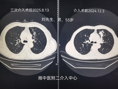 湖南中医药大学放射介入中心创新治疗模式显奇效(图1)