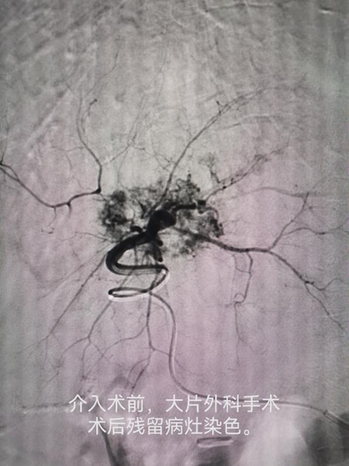 湖南率先开设细胞和基因治疗门诊,精准医疗迈入新纪元(图2) 湖南率先开设细胞和基因治疗门诊,精准医疗迈入新纪元(图2)