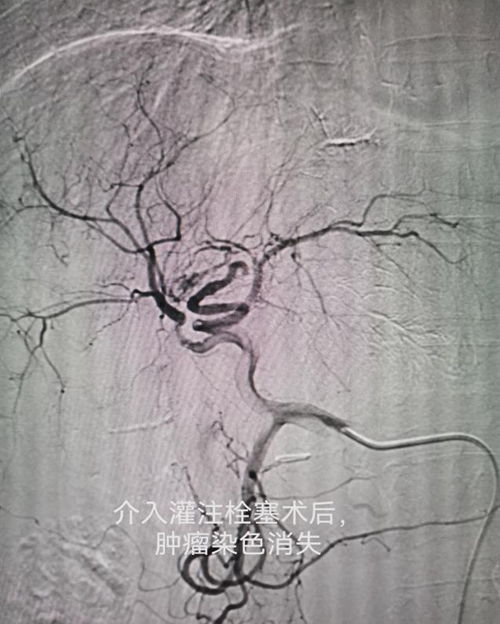 湖南率先开设细胞和基因治疗门诊,精准医疗迈入新纪元(图3) 湖南率先开设细胞和基因治疗门诊,精准医疗迈入新纪元(图3)